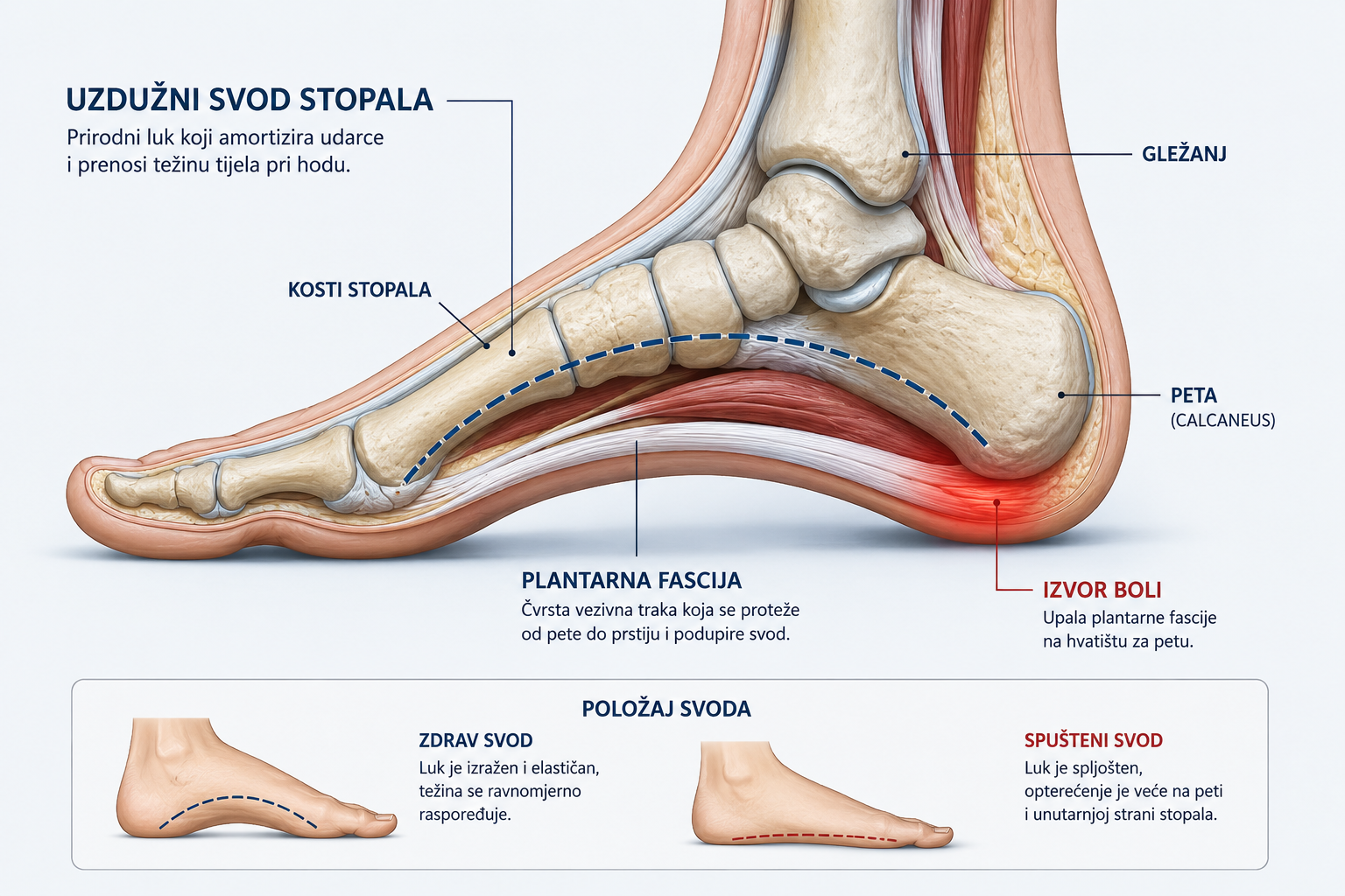 "Anatomski presjek stopala koji prikazuje uzdužni svod, petu i plantarnu fasciju kod boli u stopalu"